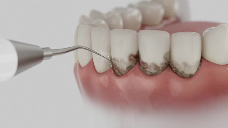 Reliable Wisdom Tooth Removal contractor in Chatham County County, GA by Dentist Open Now